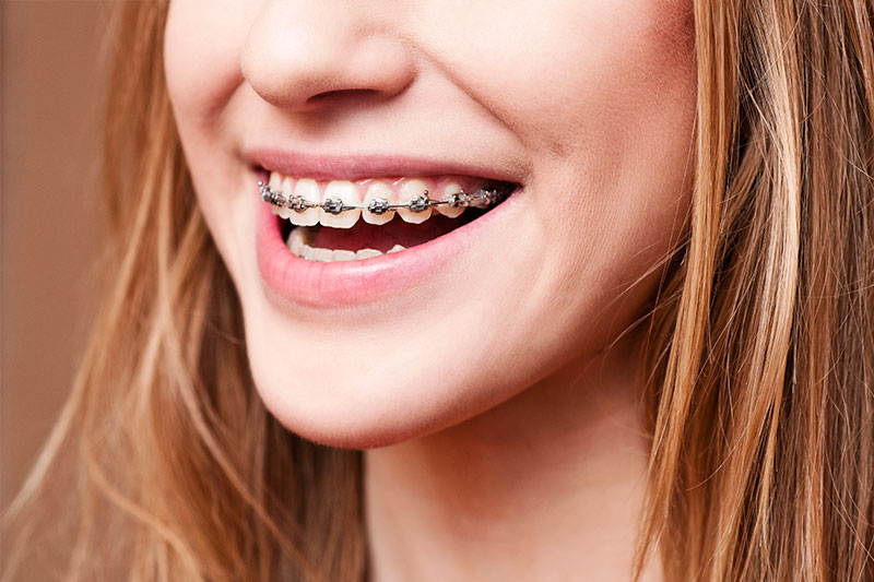 Orthodontics in Stoneham